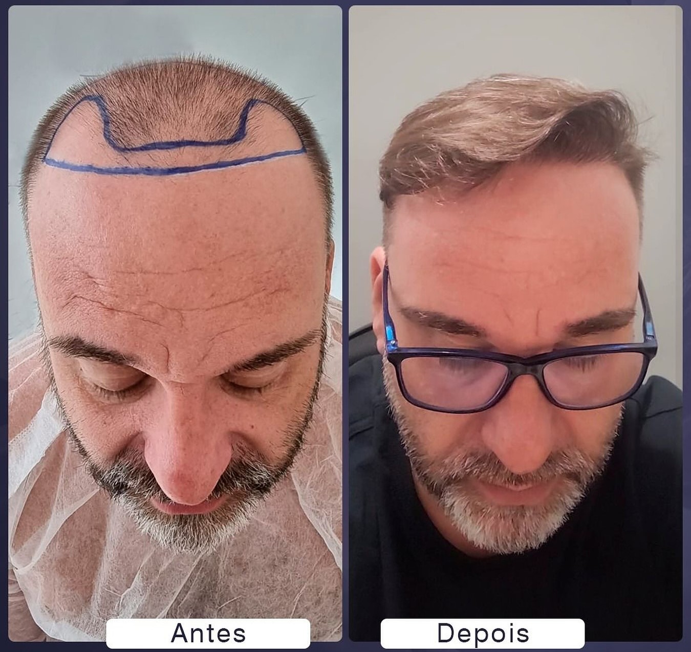 450453689_18047001355860740_4086258372076938548_n