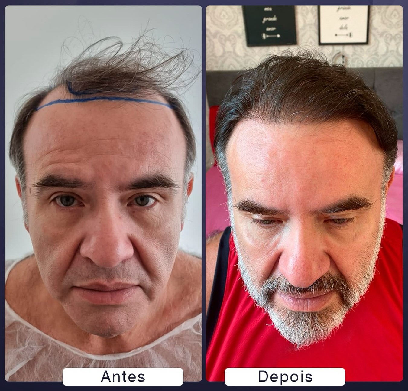 453004827_18049257502860740_6366495102802331397_n